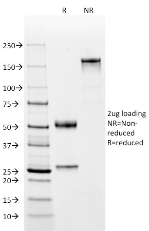 Data from SDS-PAGE analysis of Anti-Oct-2 antibody (Clone OCT2/2137). Reducing lane (R) shows heavy and light chain fragments. NR lane shows intact antibody with expected MW of approximately 150 kDa. The data are consistent with a high purity, intact mAb.